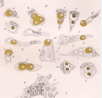 1874_Lymphoide_Markzelle_embr._Leber_und_postembr._Knochenmark